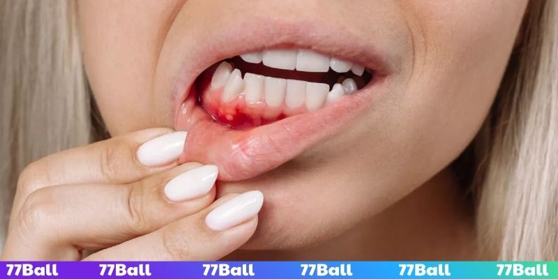 Gãy cùng lúc nhiều răng cần phải cẩn thận với điềm báo xấu